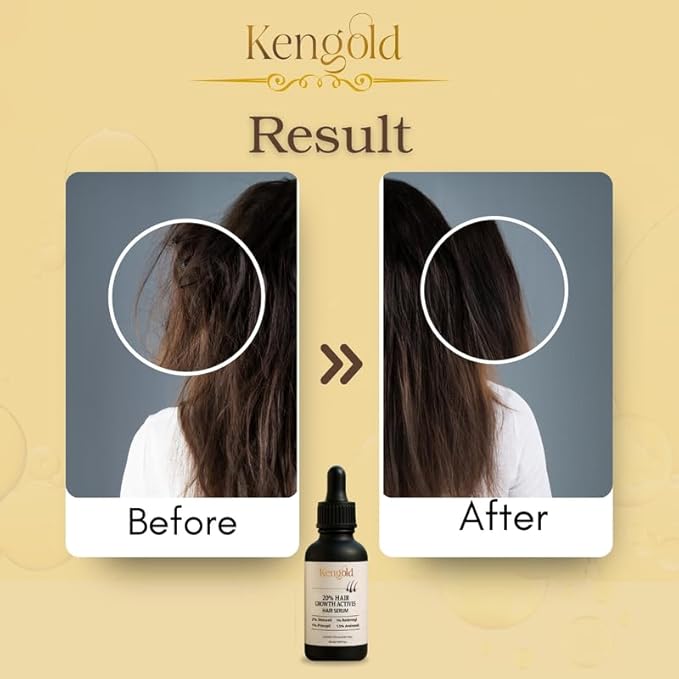 20% Actives Peptide Stem Cell Hair Growth Serum for All