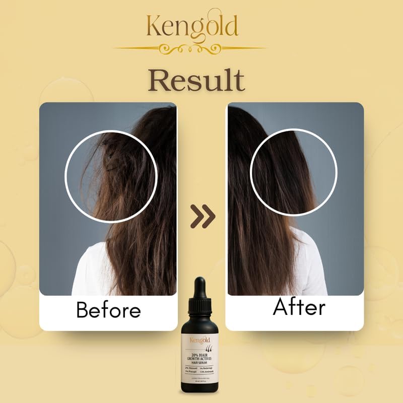Hair Growth Combo with Hair Growth Actives Serum 50ml + Peptide-Stem Cell Hair Fall Control Shampoo 100ml