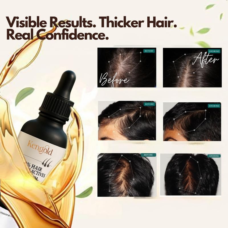 20% Actives Peptide Stem Cell Hair Growth Serum for All