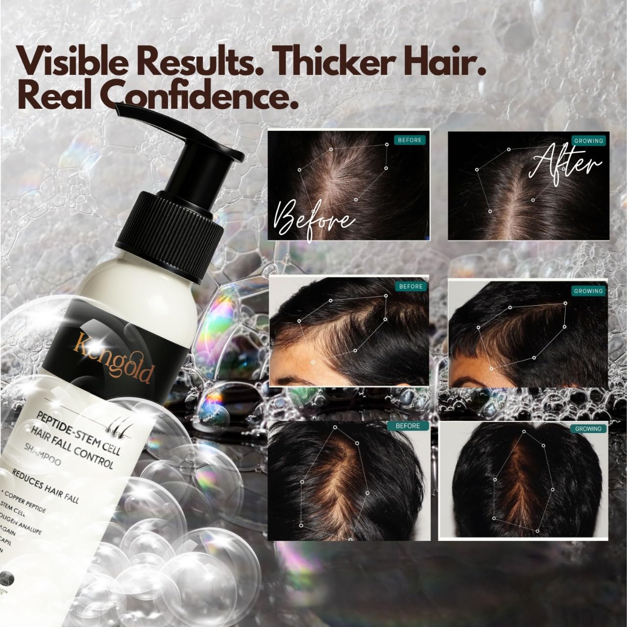 Peptide Stem Cell Shampoo For Advanced HairFall Control Plus