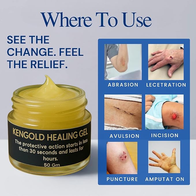 Kengold Healing Gel for Minor Cuts, Wounds, Injuries & Burns.