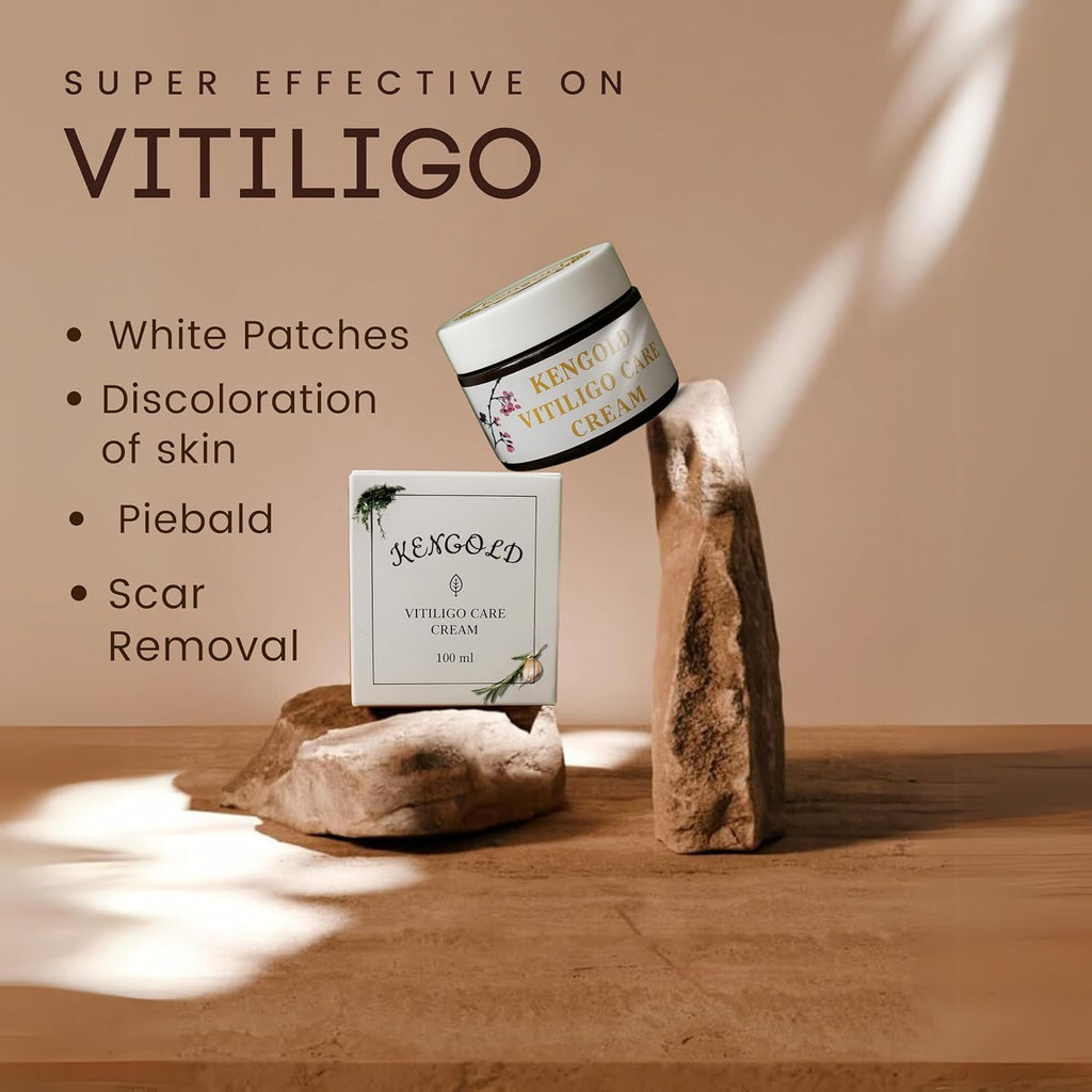 Natural Ayurvedic Vitiligo care cream | Men & Women