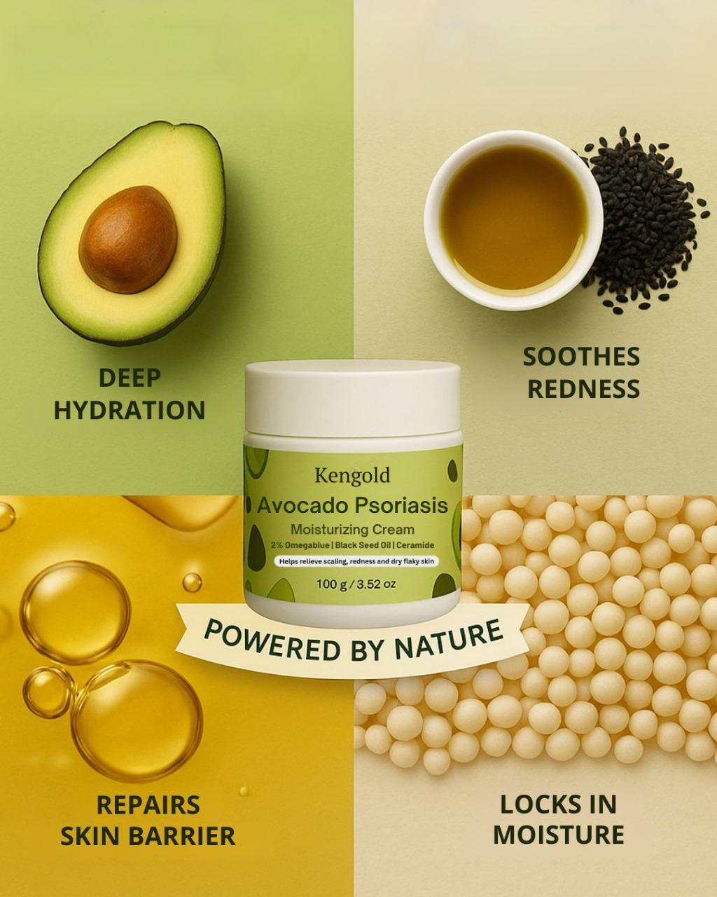 Kengold Avocado Psoriasis Moisturizing Cream for Dry & Flaky Skin.