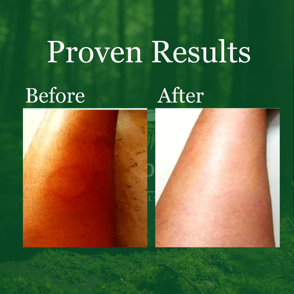 Anti Fungal & Anti Bacterial Soap  & Anti- Fungal Ayurvedic Cream